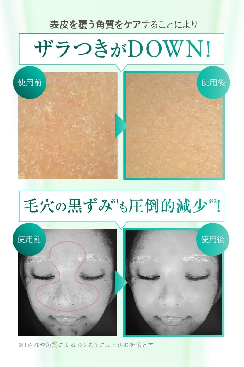 【Официально】 на сайте:myskin face│Травяной пилинг с микроиглами для ухода за порами в домашних условиях, совместная разработка Корейского научно-исследовательского института косметики на моей коже, фото 5
