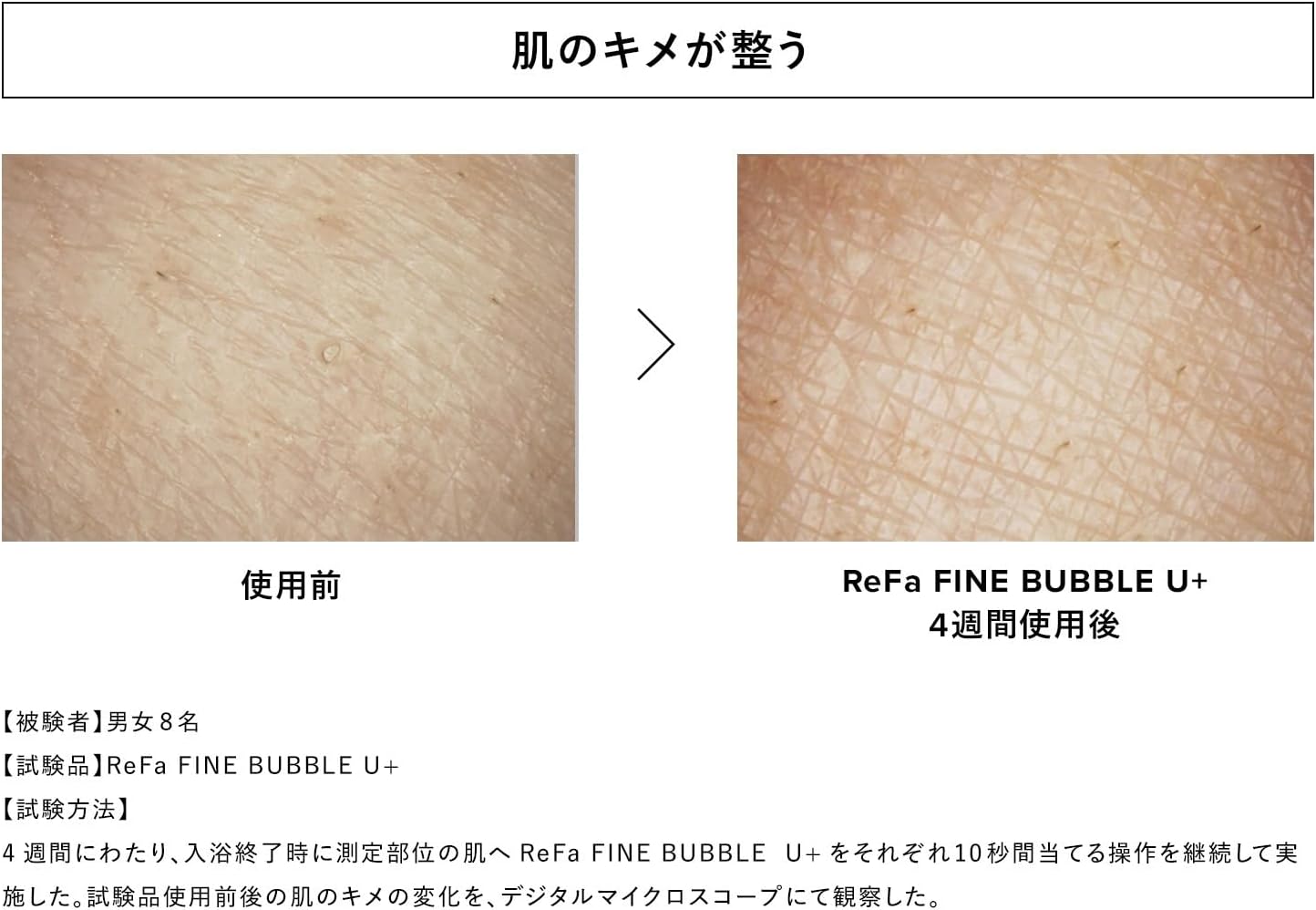◆Новый цвет ◆ [Официальный магазин ограничен] Refa FINE BUBBLE U+ / ReFa FINE BUBBLE U+ и набор для покупок (M фиолетовый) Модель Water stop Модель M фиолетовый water stop, фото 9
