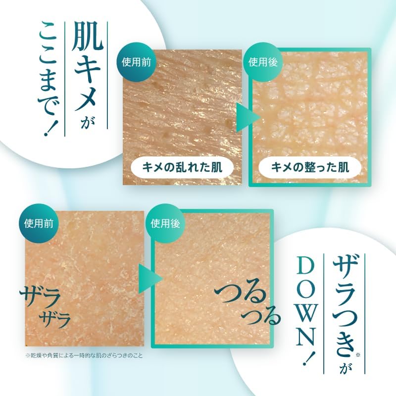 【Официально】на сайте:myskin Onispicule для ЛИЦА│Травяной пилинг с микроиглами для ухода за порами в домашних условиях Совместная разработка Корейского научно-исследовательского института косметики по кератиновому уходу за моей кожей для уменьшения угрей, фото 7