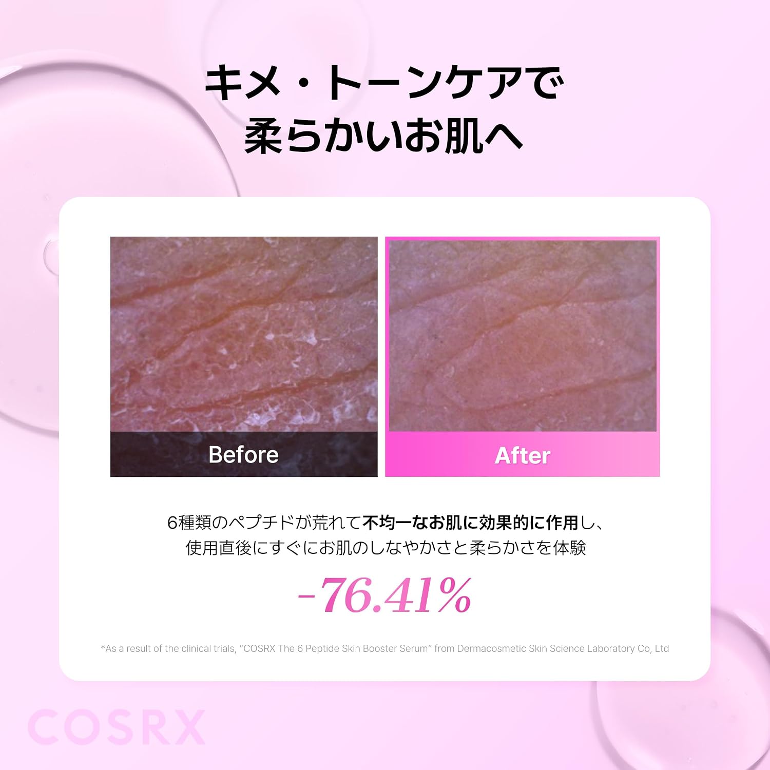 Пептидный бустер COSRX Введение сыворотки Пептид 6 Skin Booster Serum 150 мл Введение Жидкого пептидного тонера большой емкости, лосьона с ниацинамидом, гиалуроновой кислотой, Аллантиновой сывороткой, эмульсии для увлажнения дермы, Универсальной сыворотки, пептидной сыворотки, базовой косметики, Корейской косметики Korea Cosmetics, фото 8