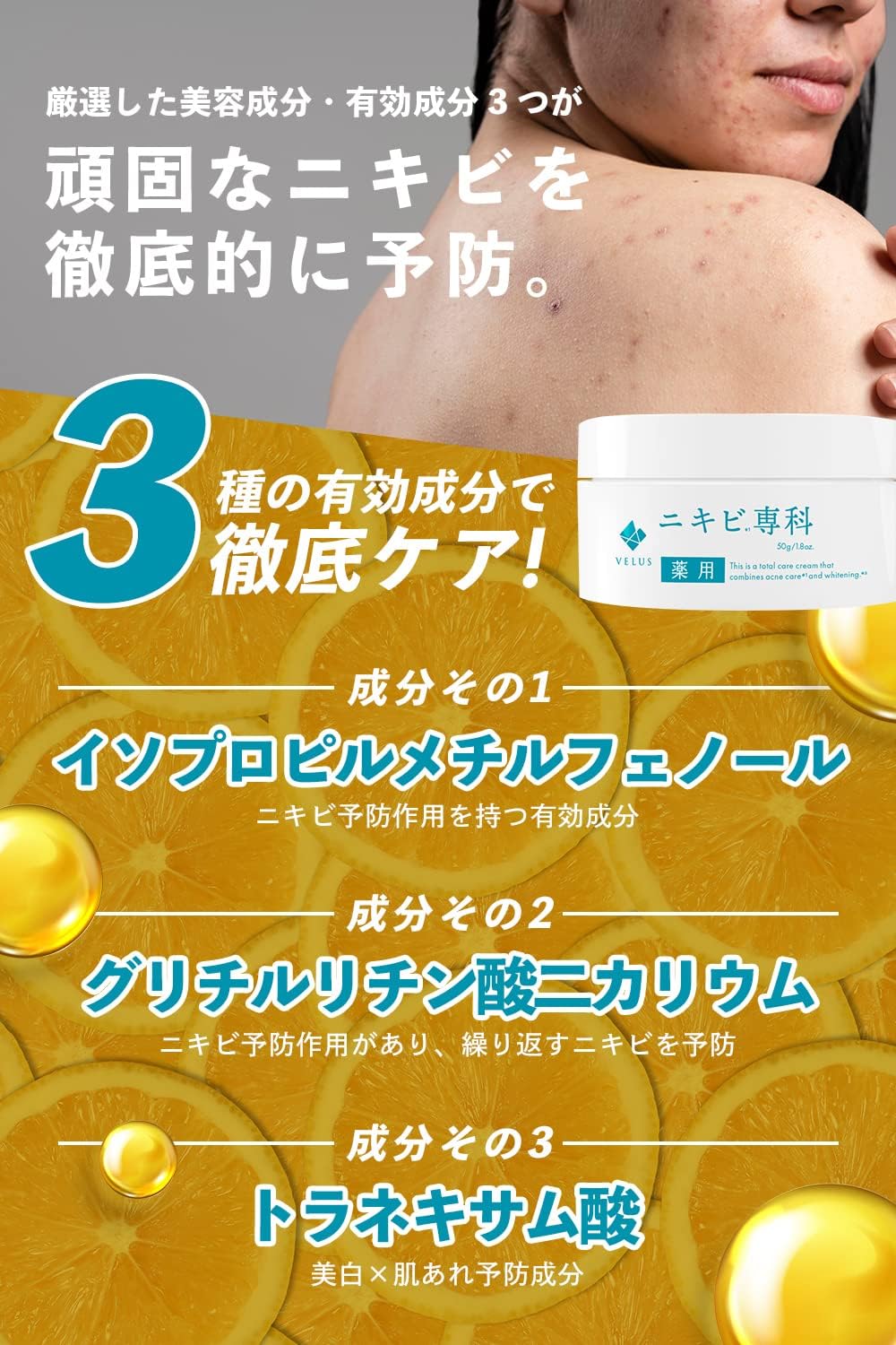 VELUS лекарство от угревой сыпи Senka gel Уход за кожей спины и всего тела для профилактики угревой сыпи, 50 г квазинаркотического геля для тела, фото 4