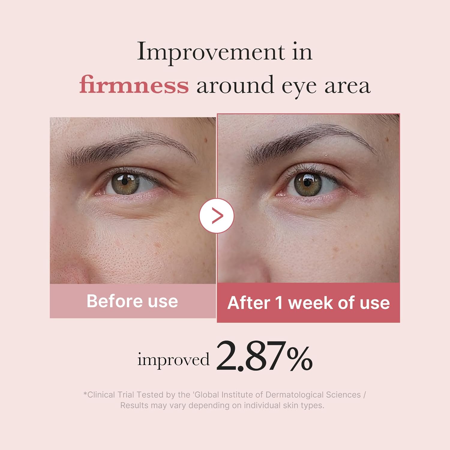 Medicube PDRN Розовый пептидный крем для век Age skin Make-up essence Увлажняющий сухой Увлажняющий крем Kimetsuya, фото 4