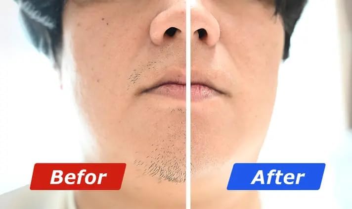 Мужская маленькая электробритва, Высокая мощность 7000 об/мин. KALOS BEAUTY TECHNOLOGY CUVER Electric Shaver, Маленькая бритва, Мужская бритва (водонепроницаемая, полностью моющаяся по стандарту IPX7), Электробритва, Электрическое бритье, Электрическая, фото 6